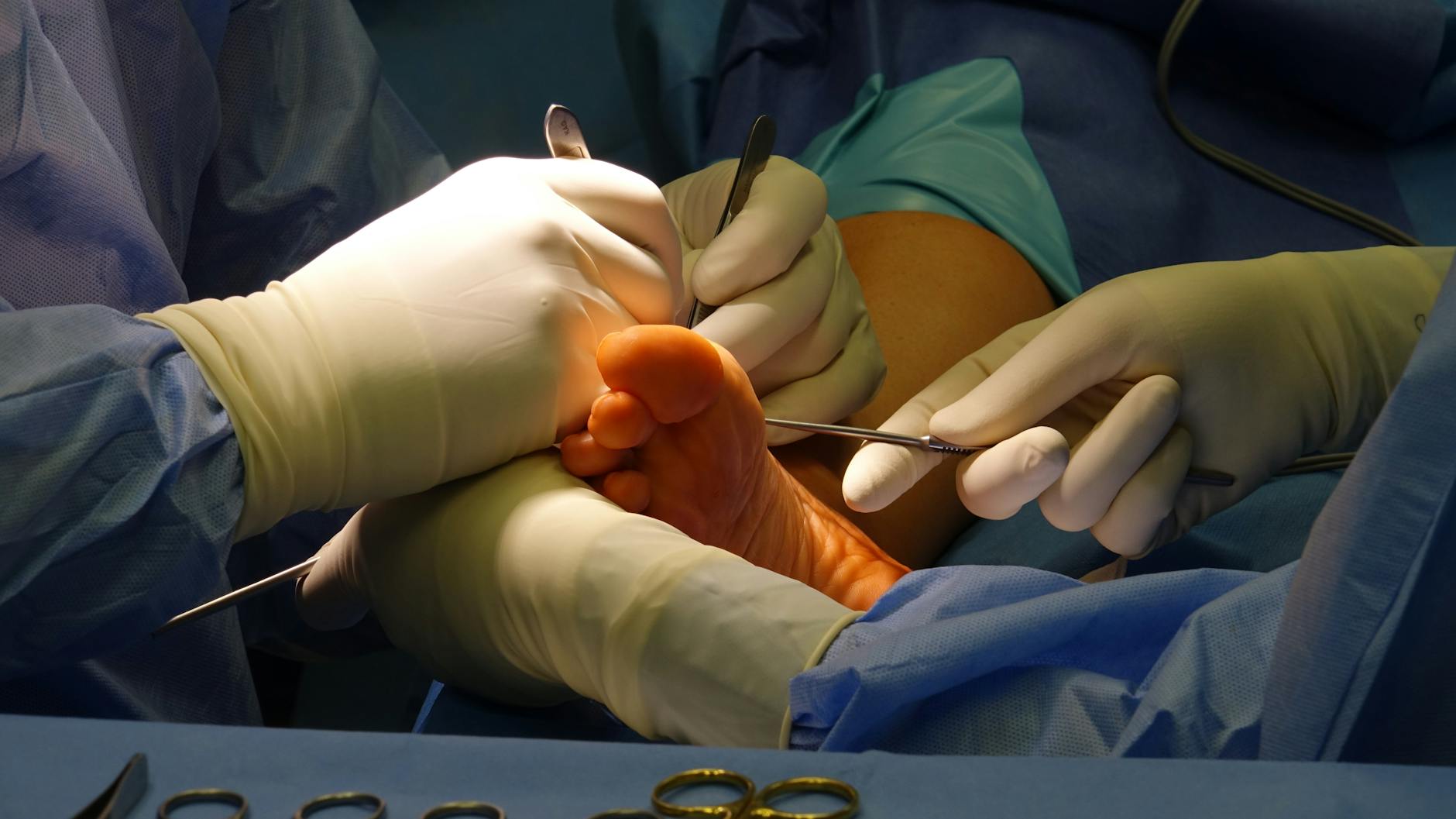 Risks and Recovery After Plastic Surgery - Professional photo for Risks and Recovery After Plastic Surgery: What You Need to Know