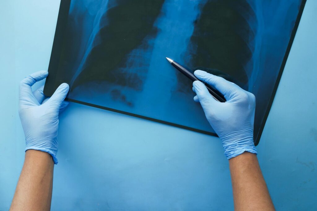Chest tube thoracostomy (Trauma Surgery) - Professional photo for Chest tube thoracostomy