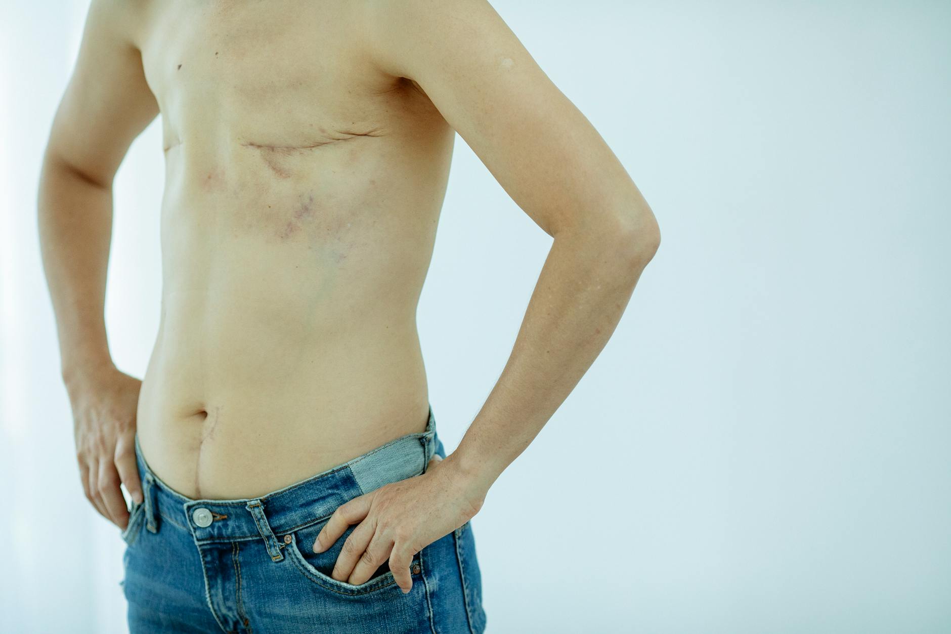 Breast Lift: Mastopexy Procedure Explained - Professional Pexels photo